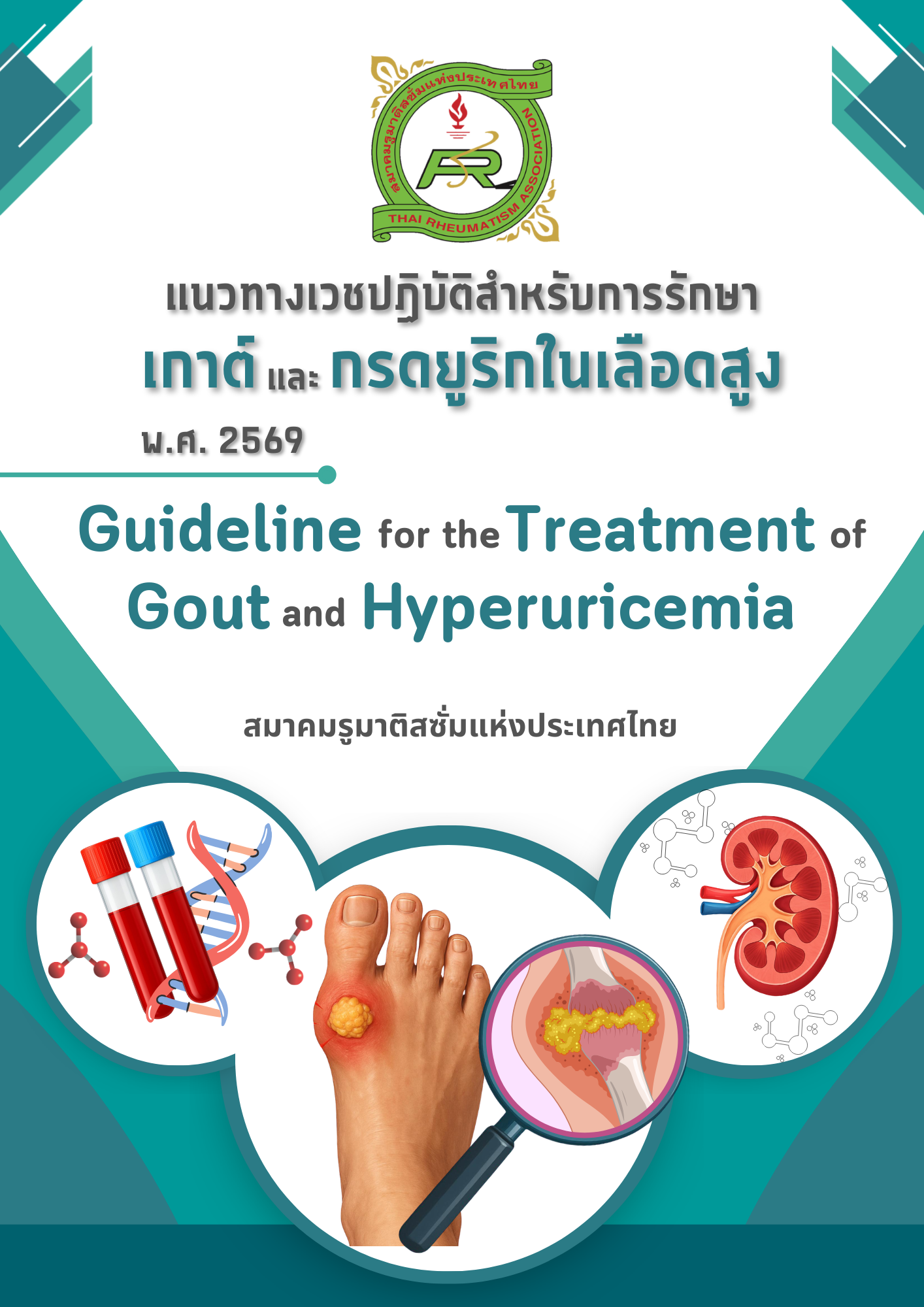 แนวทางเวชปฏิบัติสำหรับการรักษาเกาต์และกรดยูริกในเลือดสูง โดยสมาคมรูมาติสซั่มแห่งประเทศไทย พ.ศ. 2569