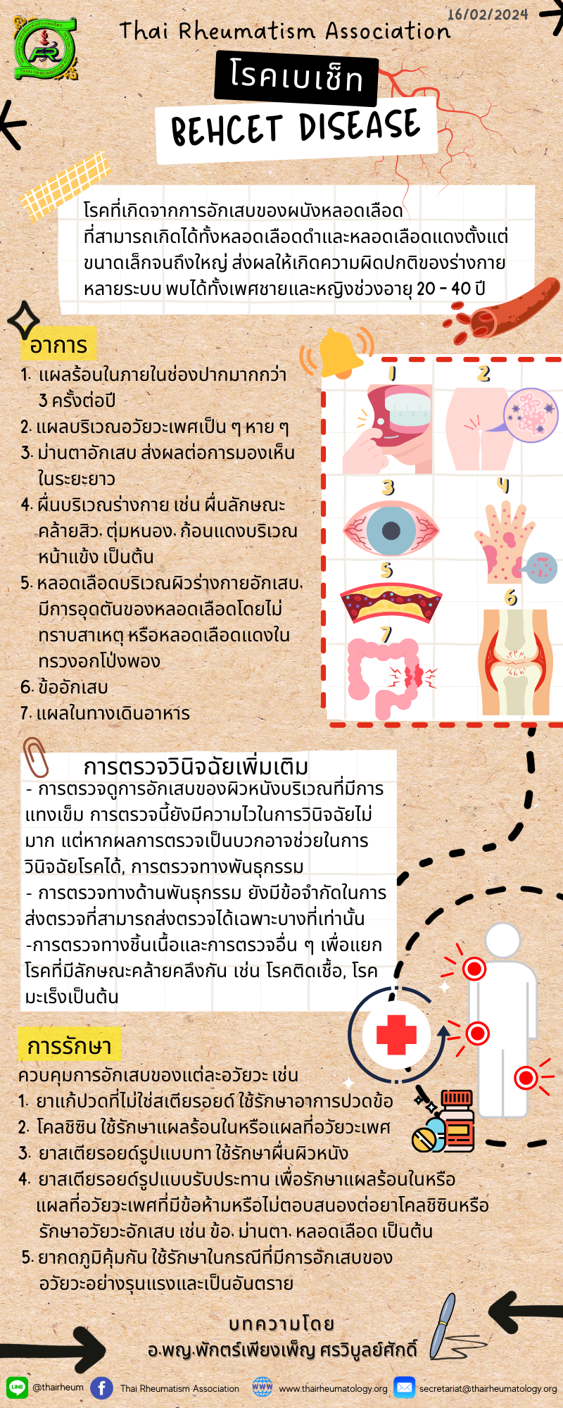 โรคเบเช็ท (Behcet Disease)